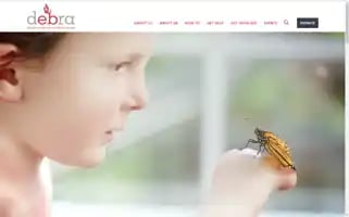 Debra.org Screenshot 2024-07-02 07:57:23