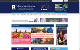 Pathologyoutlines.com Screenshot 2024-05-13 08:10:26