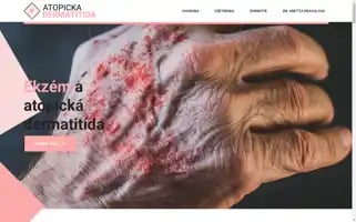 Atopickadermatitida.sk Screenshot 2024-05-19 19:45:30