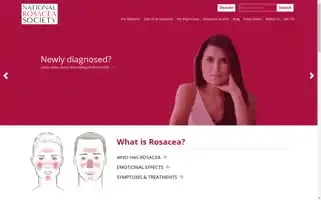 Rosacea.org Screenshot 2024-06-29 20:56:40